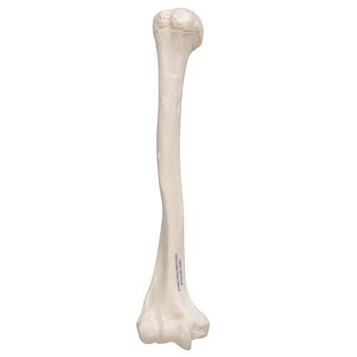 <p>What bone is this?</p>