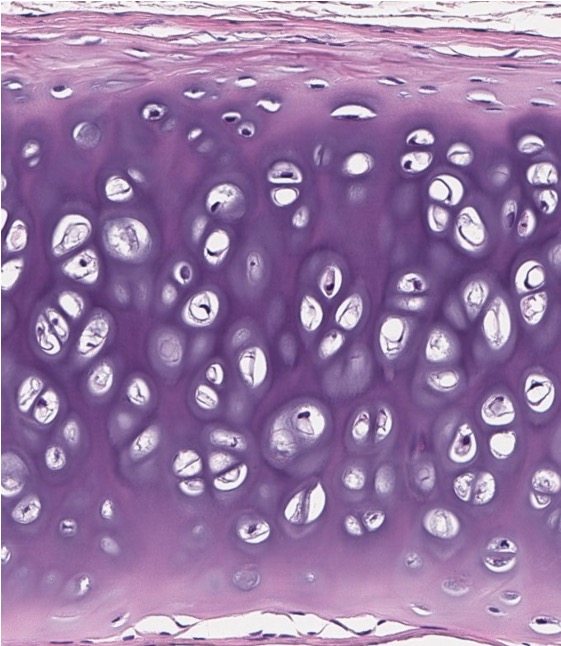 <p><span style="font-family: "Calibri Light";">1. Which type of CT makes up the bulk of this image?<br><br>2. Does it have a perichondrium?</span></p>