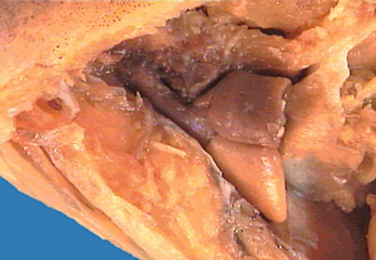 <p>This image shows the circulatory system of the classes Agatha, Chondrichthyes, Sarcopterygii, and Actinopterygii (all fishes). This system has ____ chambers in the heart and its circulation involves a single <strong>OR </strong>double circuit.</p>