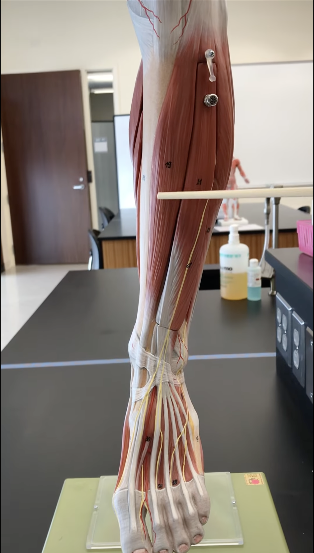 <p>Tibialis Anterior</p>