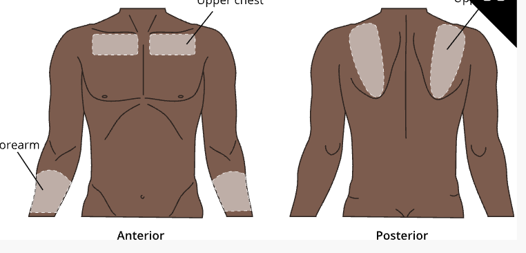 <p><span>¼ to ½ inch needle</span></p>