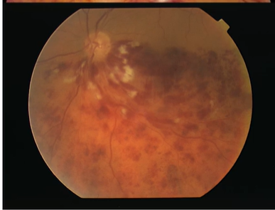 <p>Describe the picture</p>