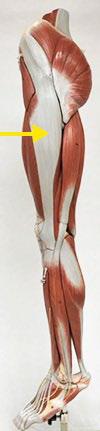 <p>Iliotibial tract/band</p>