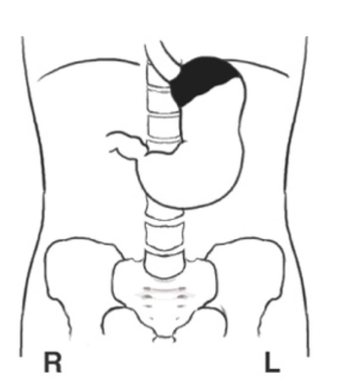 <p>What patient position is this?</p>