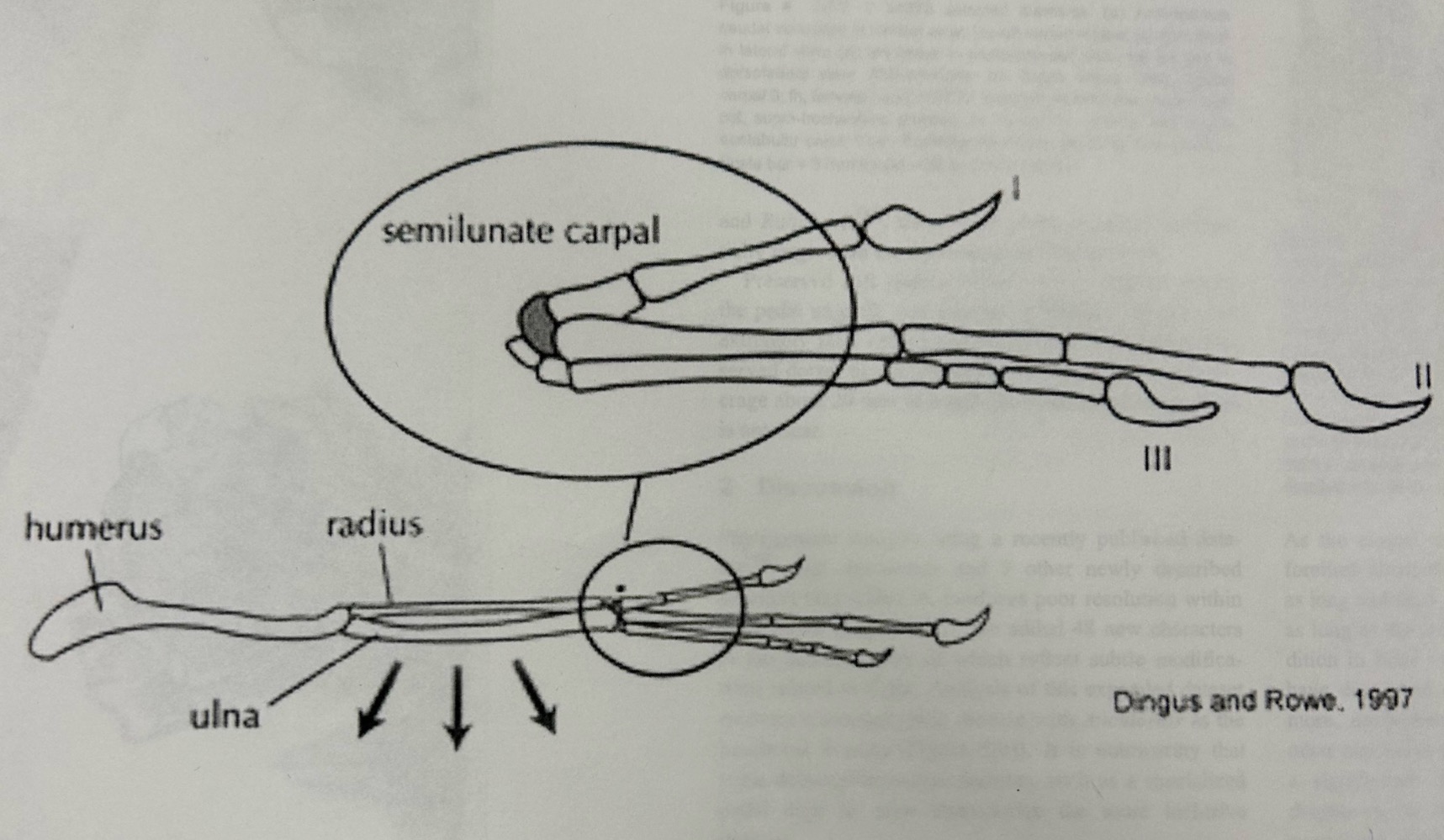 <p>What type of wrist is this?</p>