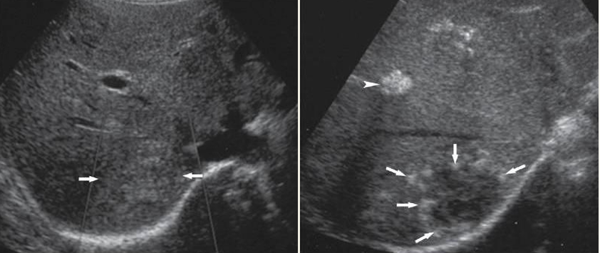<p>what lesion is this?</p>