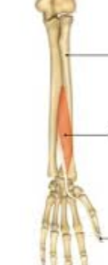 <p>What muscle is being shown?</p>