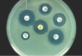 <p>What test is this called </p>