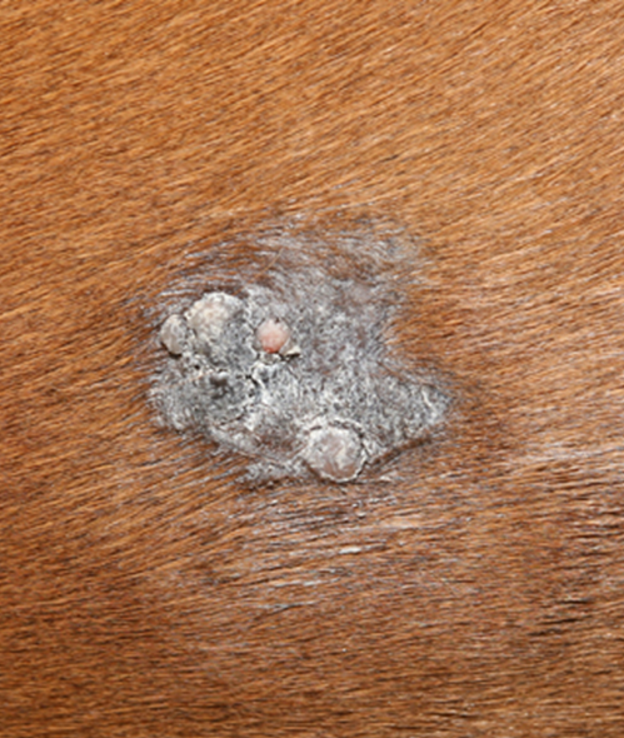 <p>Areas of 2 or more types of sarcoids with no distinguishable margin between them. (This one is verrucose with fibrobalstic parts).</p>