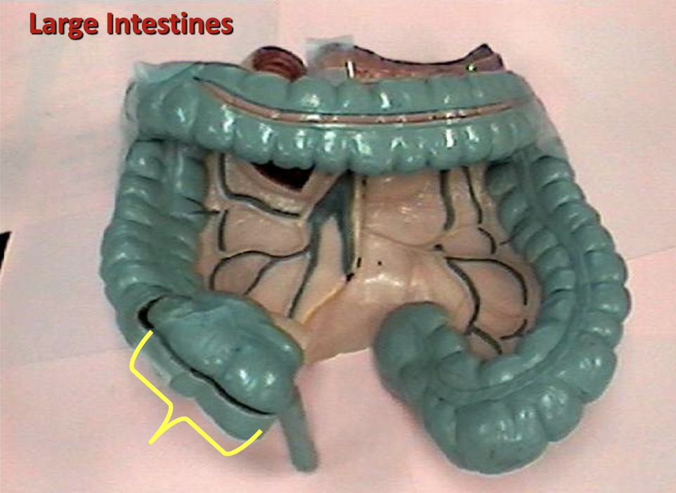 <p>Identify the organ.</p>