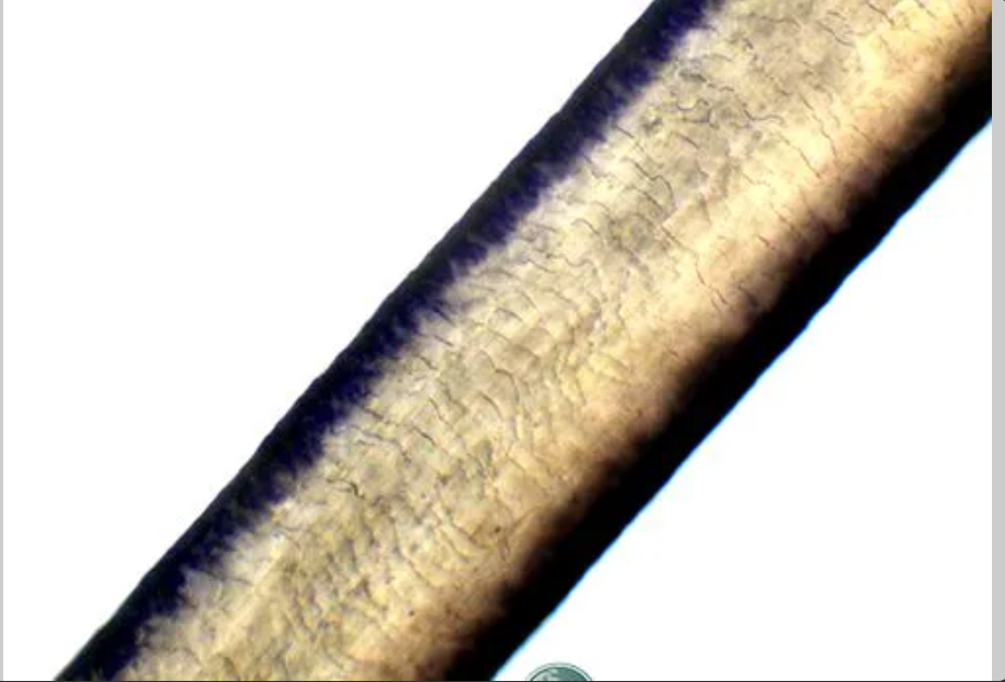 <p><span>How would you describe this cuticle?</span></p>