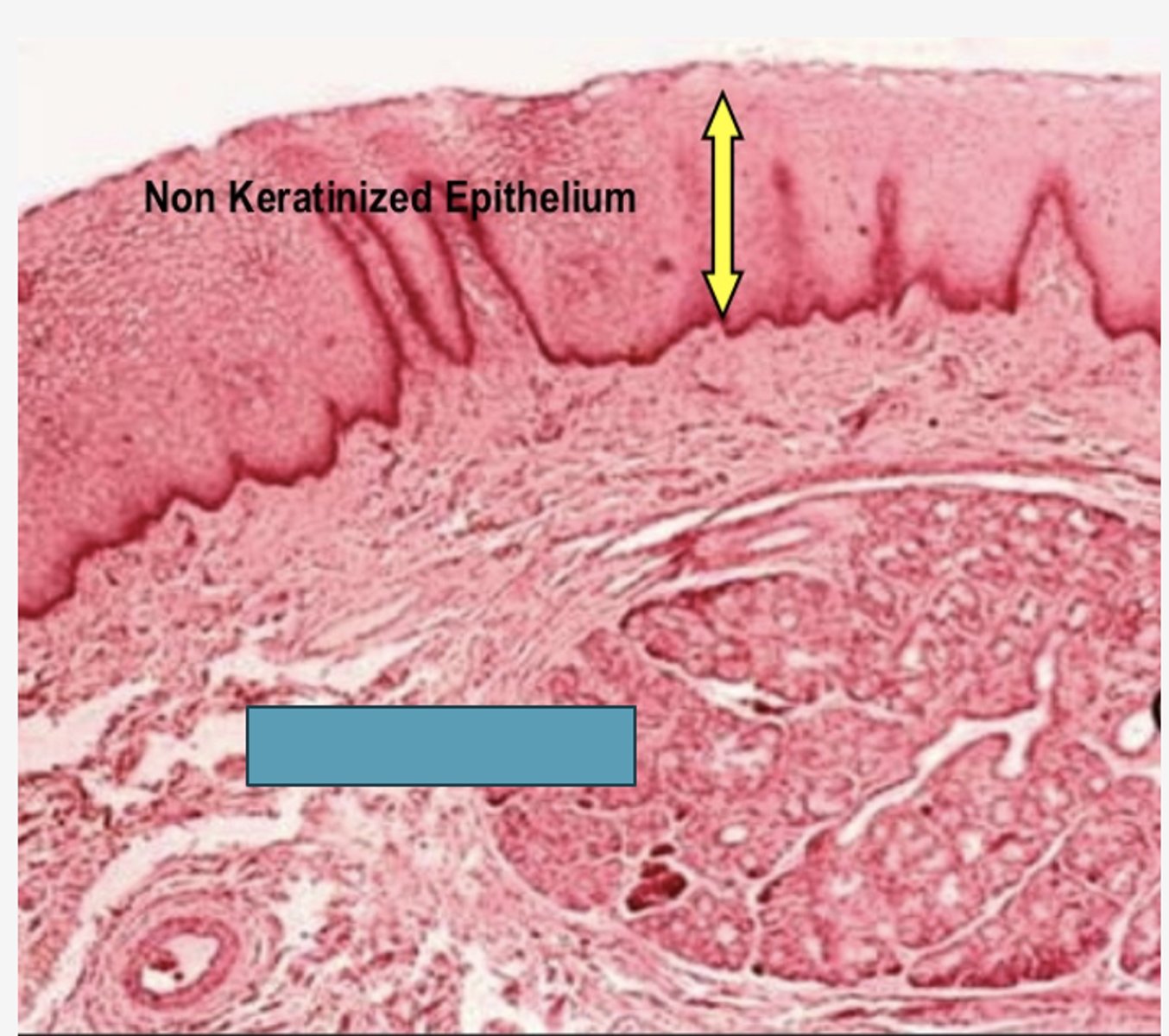 <p>Identify the type of mucosa</p>
