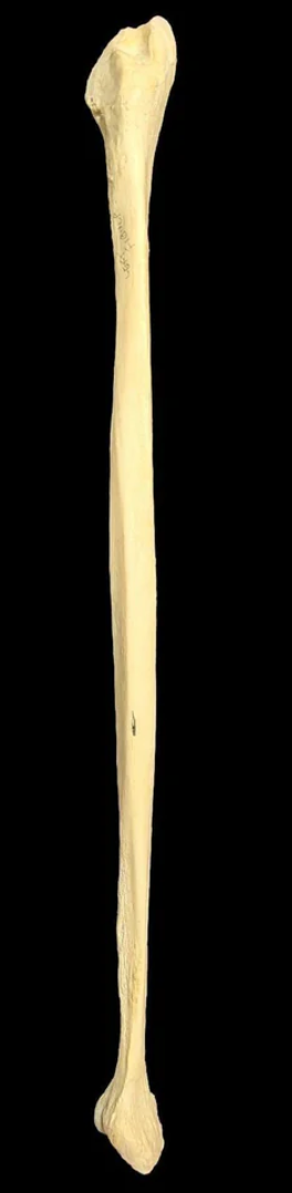 <p>Identify the bone</p>