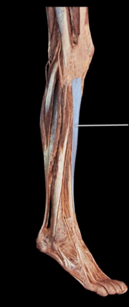 <p>What muscle is this?</p>