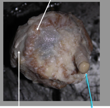 <p>What is the arrow pointing at?</p>