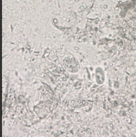 <p>genus, species, stage</p>