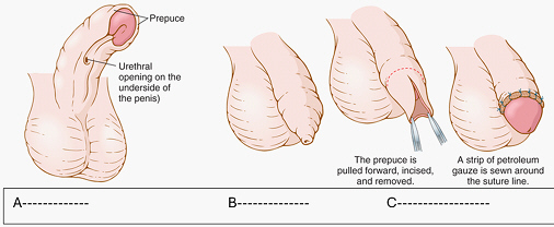 <p>3 (1-3)</p>