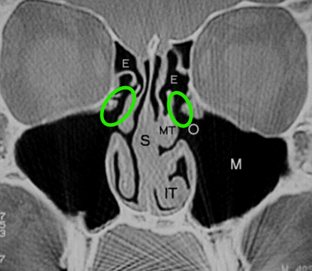 term image