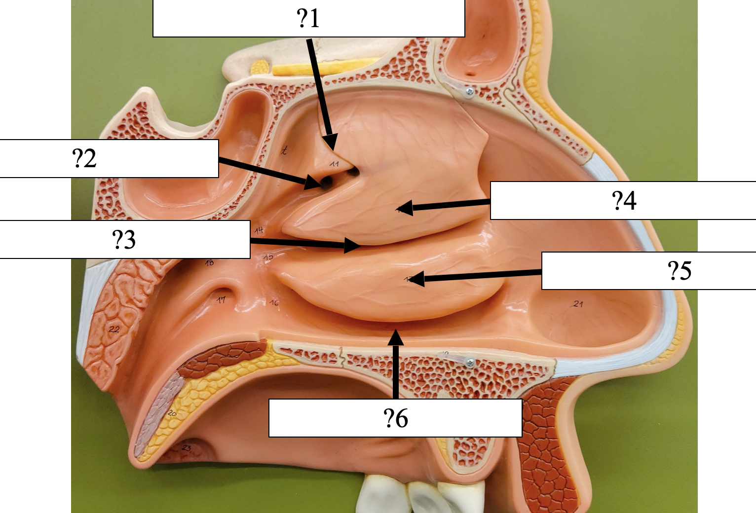 <p>3 Name the groove?</p>