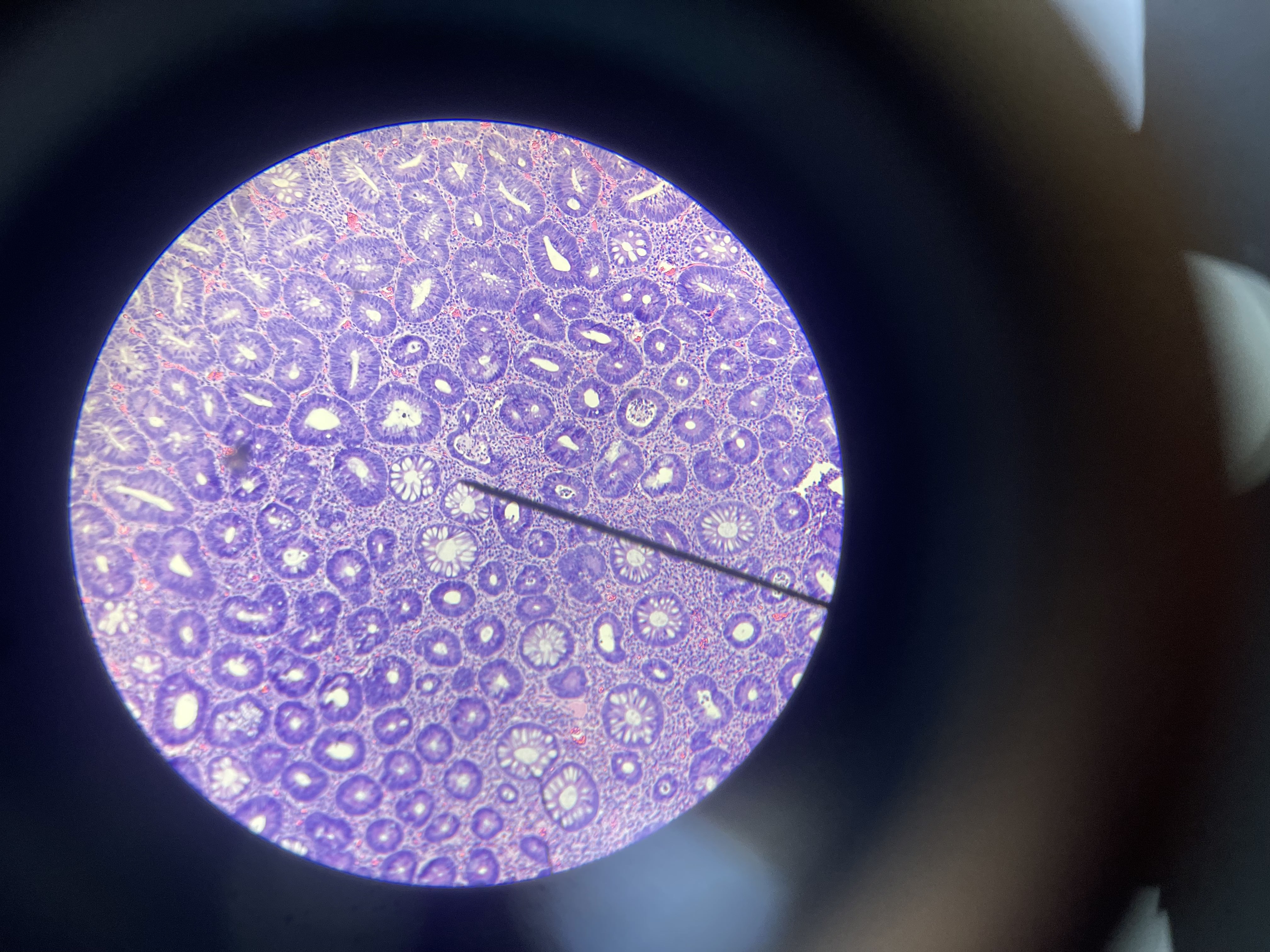 <p>What is the diagnosis?</p>