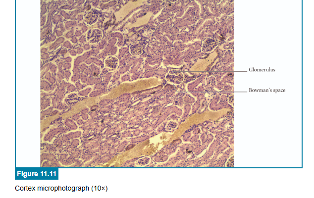 <p>correct answers</p>