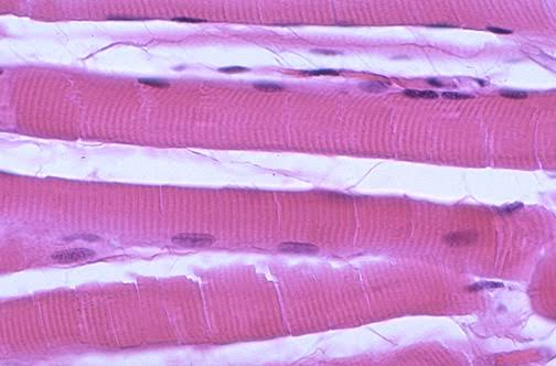 <p>skeletal muscle longitudinal section</p>