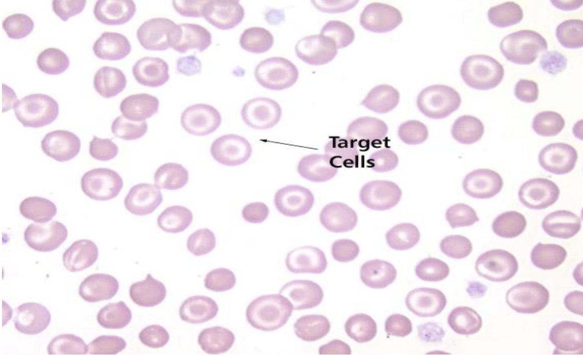 <p>Target Cells </p>