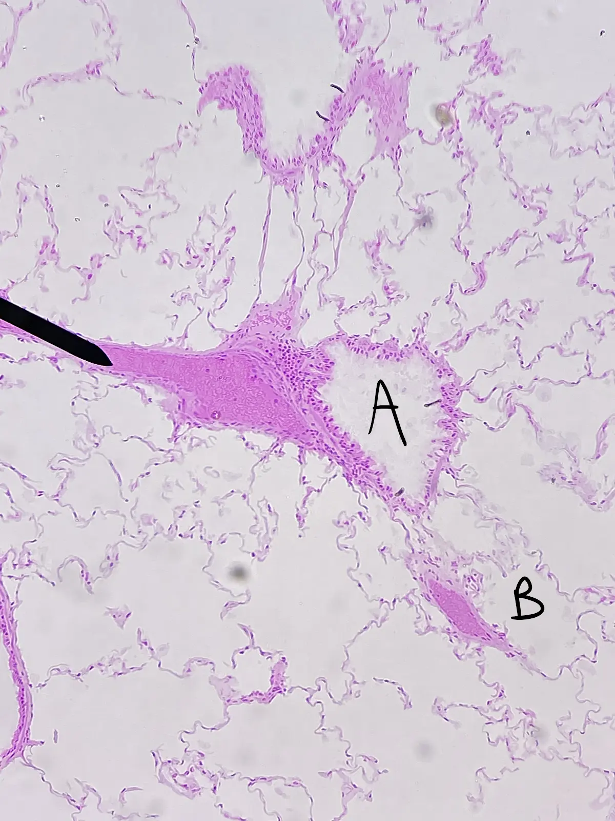 <p>What kind of tissue lines the Bronchiole?</p>