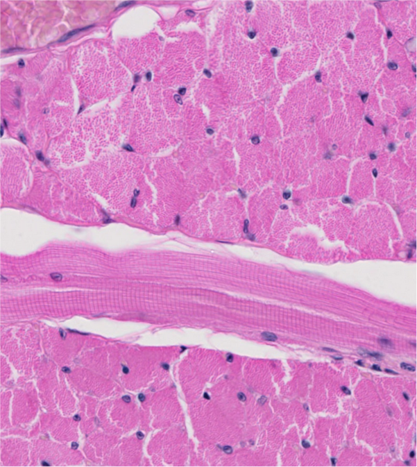 <p><span style="font-family: "Calibri Light";">ID the type of muscle. <br></span></p>