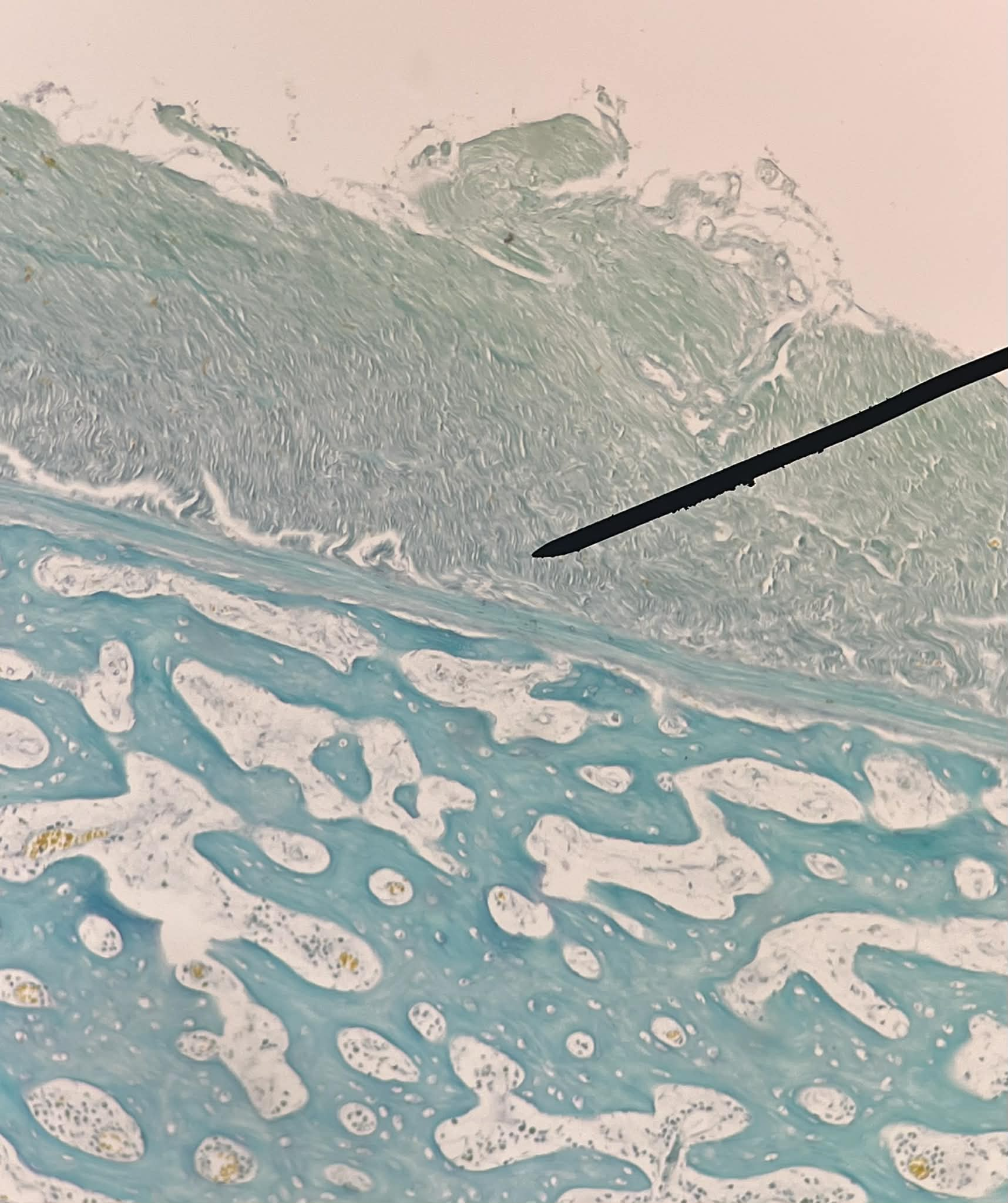 <p>Tiêu bản gì ?</p>