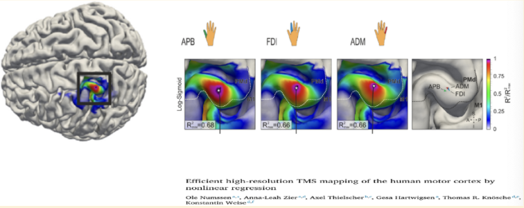 <p>maps out individual fingers </p>
