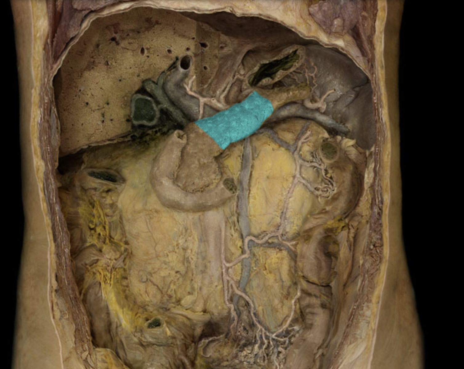 term image