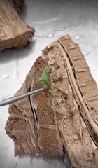 <p>Name the ligament</p>