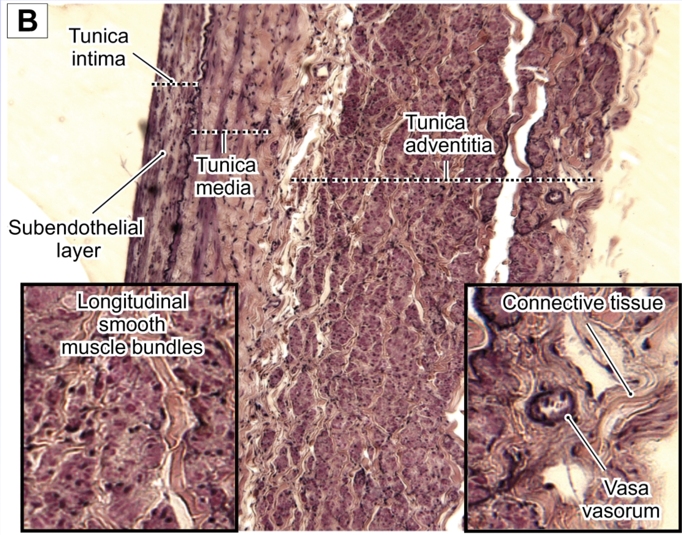 <p>large vein</p>