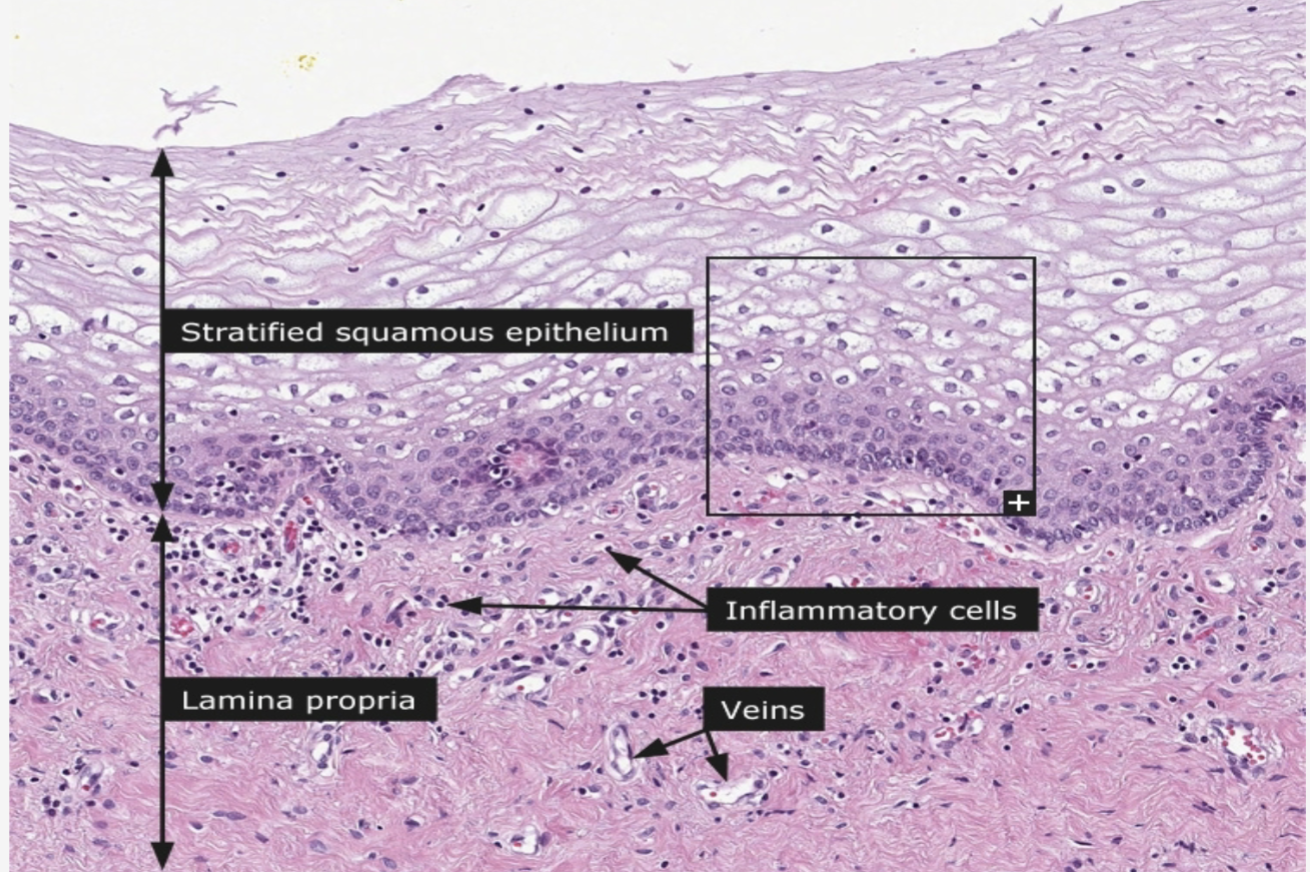 <p>identify the mucosa</p>
