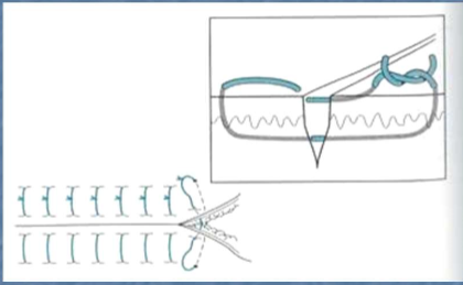 <p>What type of stitch is this?</p>