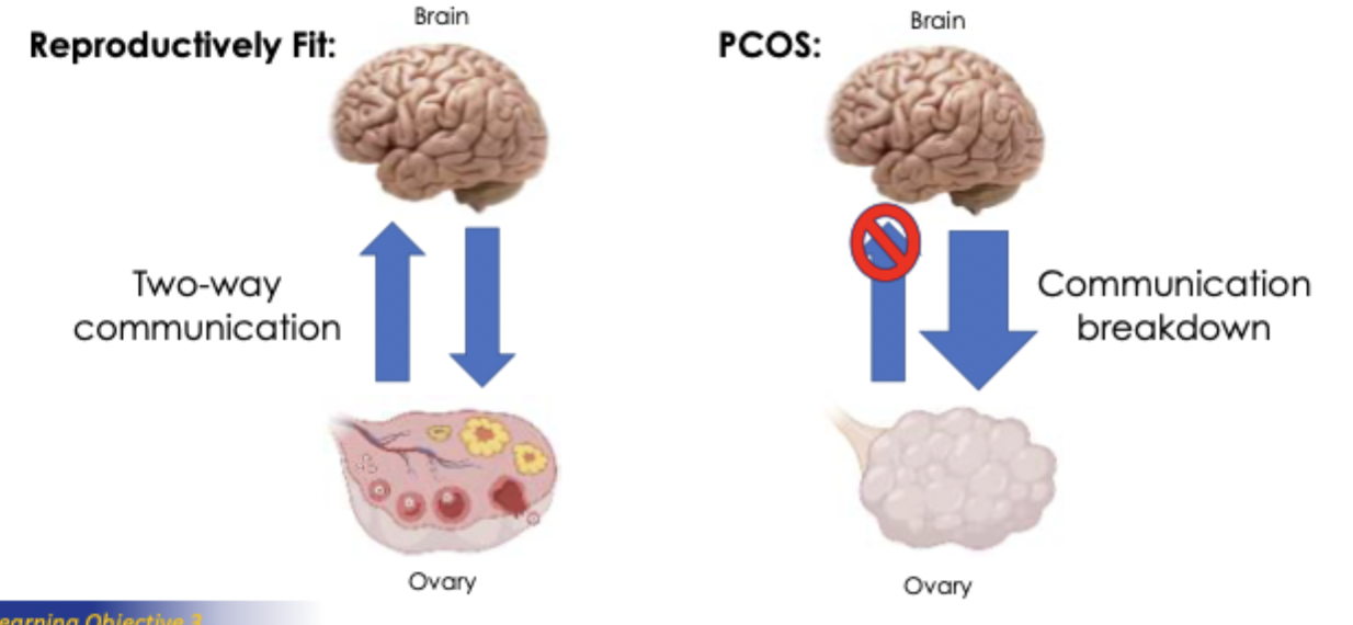 <p>brain is less sensativty to feedback so more signals sent out from brain. which causes multiple problems at the ovary. too many theca cells and increased testosterone. </p>