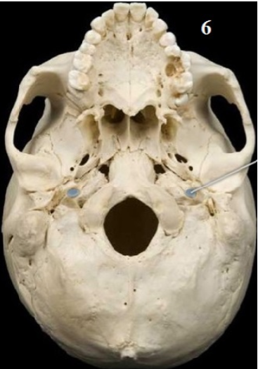 <p>Name this foramen</p>