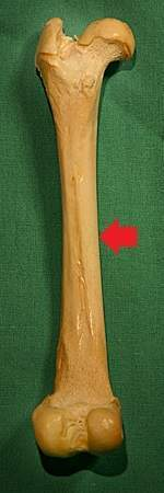 <p>Periosteum</p>