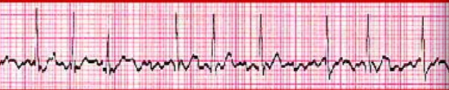 <p>what wave form is this</p>