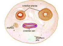 <ul><li><p>Connecting stalk elongates and becomes narrower as pregnancy progresses </p></li><li><p>Umbilical cords are generally 55-61cms long Can range from 40 to +90cms (neither extreme is good, beyond 70cms is concerning) </p></li><li><p>Umbilical cord is a conduit for the umbilical vessels </p></li><li><p>2 arteries (arise from internal iliac arteries and carry blood from fetus to placenta) </p></li><li><p>1 vein (arises from venules in the placenta and carries blood from placenta to fetus) </p></li><li><p>Vein carries oxygenated blood and nutrients from mother to fetus </p></li><li><p>No muscle except smooth muscle of the blood vessels </p></li><li><p>No nerves – vasodilation or vasoconstriction occur via locally produced vasoactive substances (e.g. nitrous oxide – vasodilation &amp; catecholamines – vasoconstriction) </p></li><li><p>Umbilical structures are supported by Wharton’s jelly = mesenchymal substance (connective tissue) in which the umbilical blood vessels are supported function: to resist compressive and bending forces on the umbilical vessels</p></li></ul><p></p>