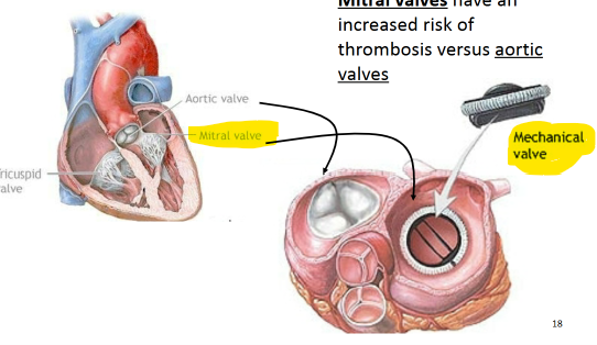<p>Which heart valve position has a higher risk of thrombosis?</p>