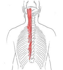 <p>O: Transverse processes of T1-T6</p><p>I: Medial part of the occipital bone between the superior and inferior nuchal lines</p><p>N: Spinal nerves</p><p>Fx: Rotates and extends the head and neck</p>