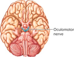 <p>Nerve that controls 4 out of 6 muscles of the eye and constricts the pupil.</p>