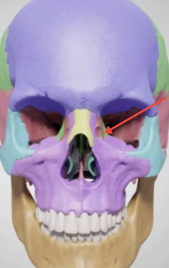 term image