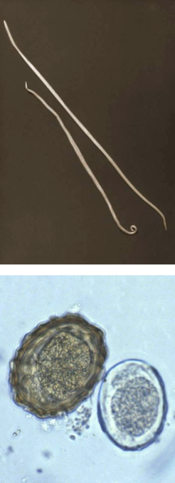 <ul><li><p>first image is adult form and second is eggs</p></li><li><p>human roundworm </p></li><li><p>causes Ascariasis</p></li></ul><p></p>