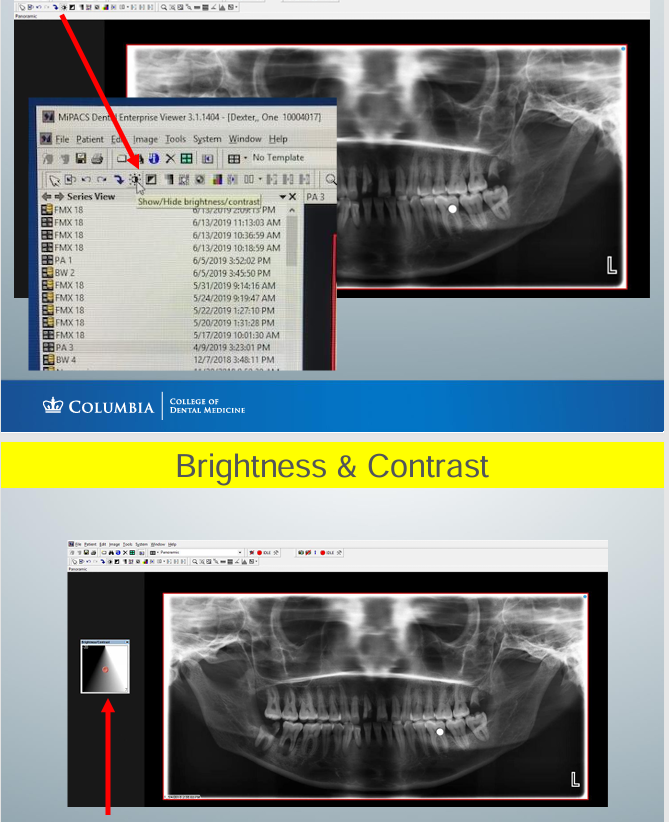<p>-2 ways to change brightness and contrast:</p><p>1) move mouse from R to L and up to down across the image to adjust parameters</p><p>2) using the box- can move small red circle in the box to adjust brightness and contrast</p>