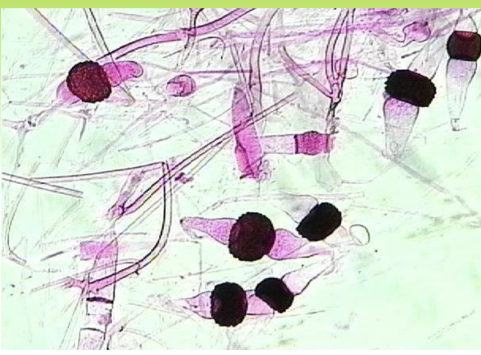 <p>phylum Zygomycota</p><ul><li><p>Mainly saprotrophs</p></li><li><p>some are parsites of soil protists or worms</p></li><li><p><strong><em>Rhizopus stolonifer</em></strong>—black bread mold</p><ul><li><p>Have specialized hyphae</p></li><li><p>reproduce sexually</p><ul><li><p>The ends of (+) and (−) hyphae join, haploid nuclei fuse, and a thick-walled <strong>zygospore</strong> forms which is dormant before meiosis and germination then turns into aerial hyphae with sporangia at tips produce many spores</p><ul><li><p>spores then are dispersed by air currents and give rise to new mycelia</p></li></ul></li></ul></li></ul></li></ul><p></p>