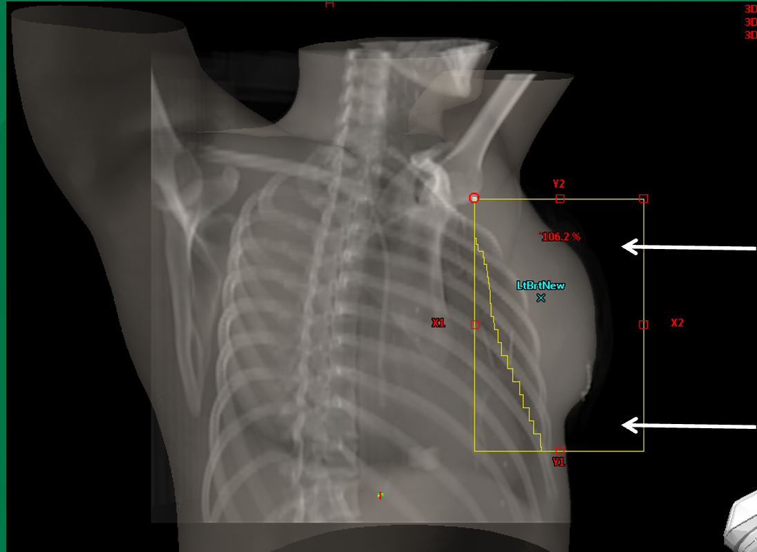 <p>How does FLASH irradiation in air affect central axis dose calculations?</p>