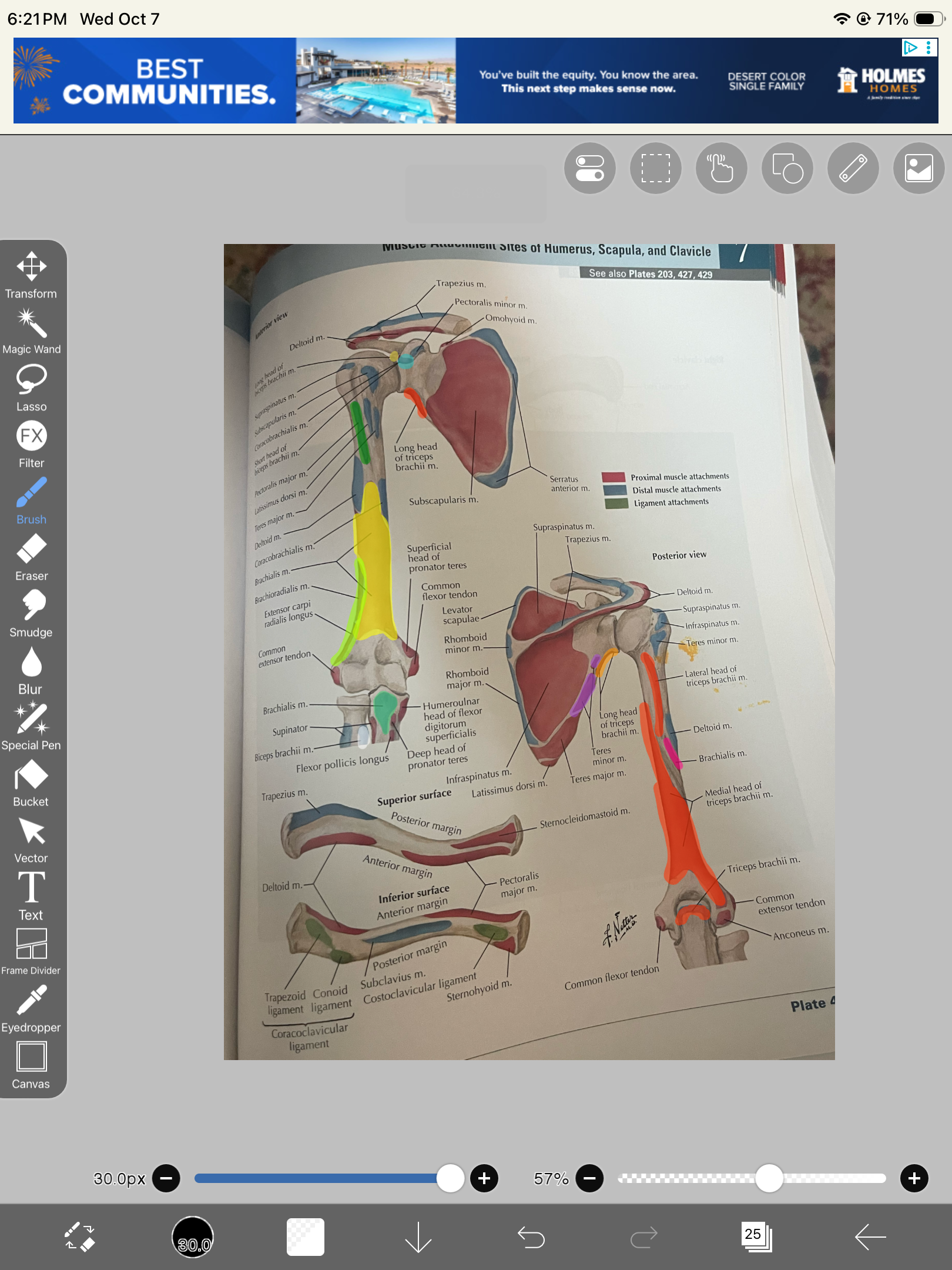 <p>Short head of biceps brachii</p>